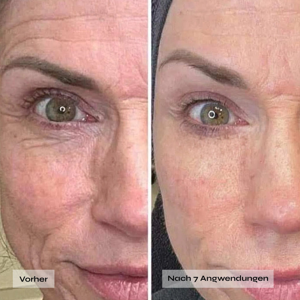 Filler Termin abgesagt