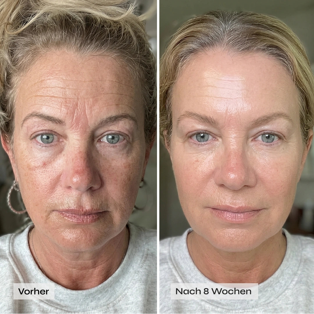 Kollagen Boosting Maske