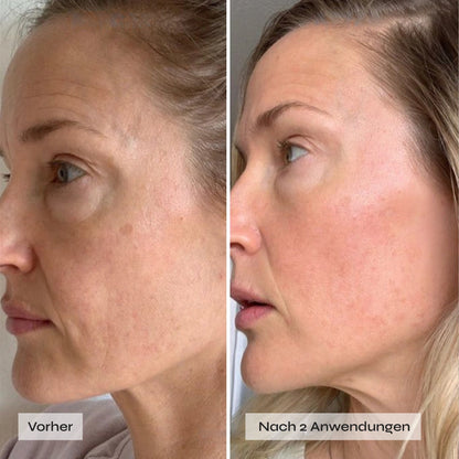 Kollagen Boosting Maske