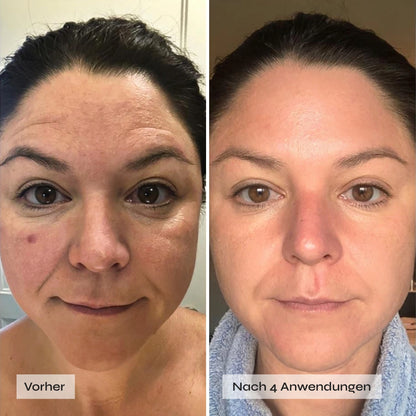 Kollagen Boosting Maske