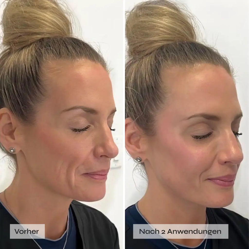Sofortige Ergebnisse nach erster Anwendung!