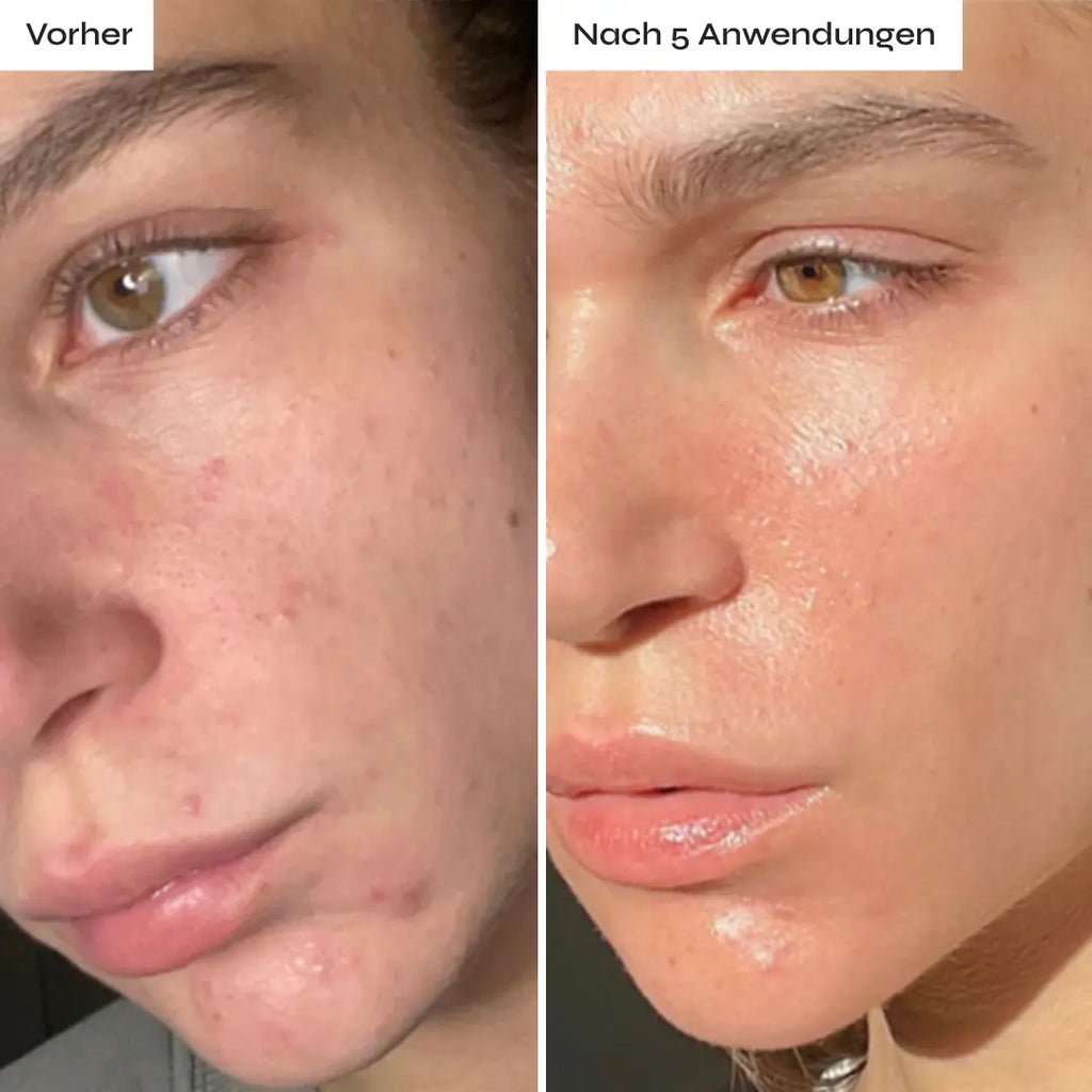 Die beste Investition in meine Haut!