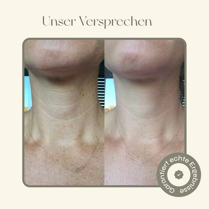 Hals Kollagen Maske