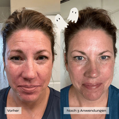 Kollagen Boosting Maske