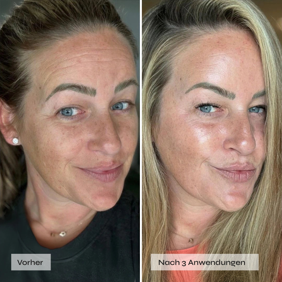 Kollagen Boosting Maske